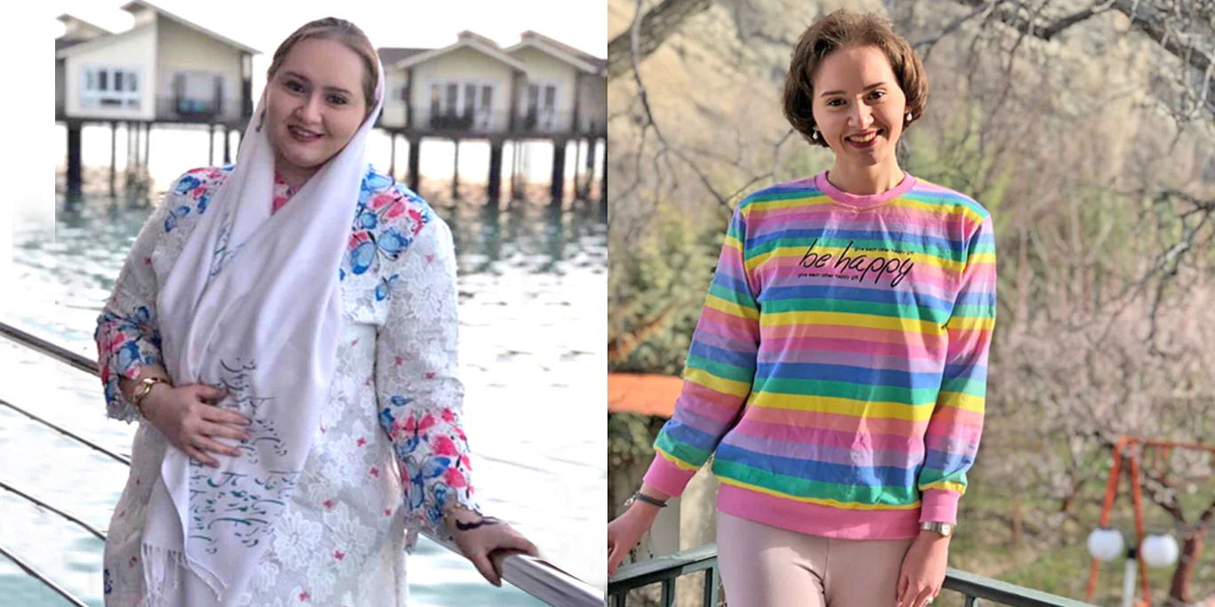 تصاویر قبل و بعد اسلیو معده Before & After