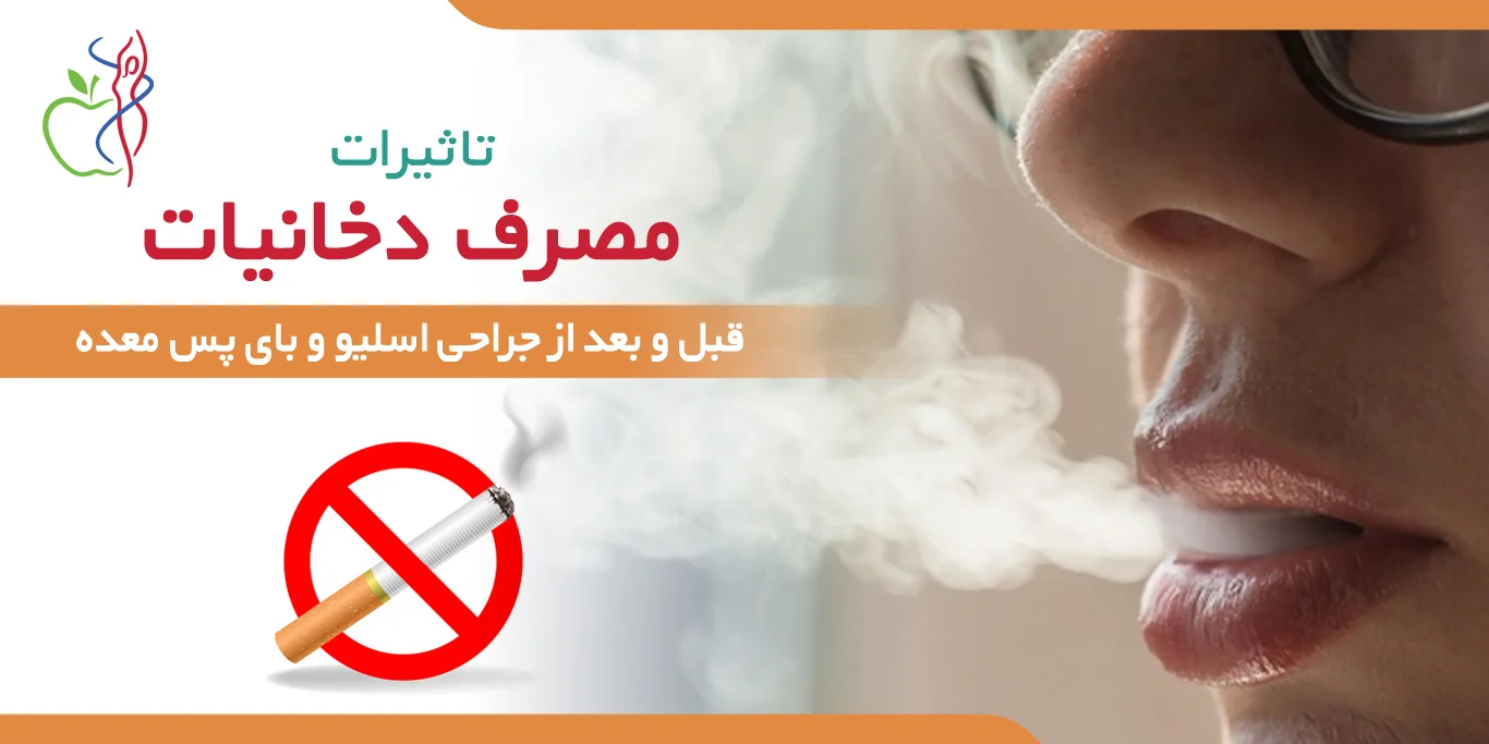 مصرف دخانیات بعد از عمل اسلیو و بای‌پس